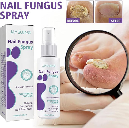 Extra Strong 100ML Toenail Fungus Treatment Spray Effective Nail Softener and Toe Nail Care Solution